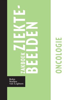 cover image of Zakboek ziektebeelden Oncologie